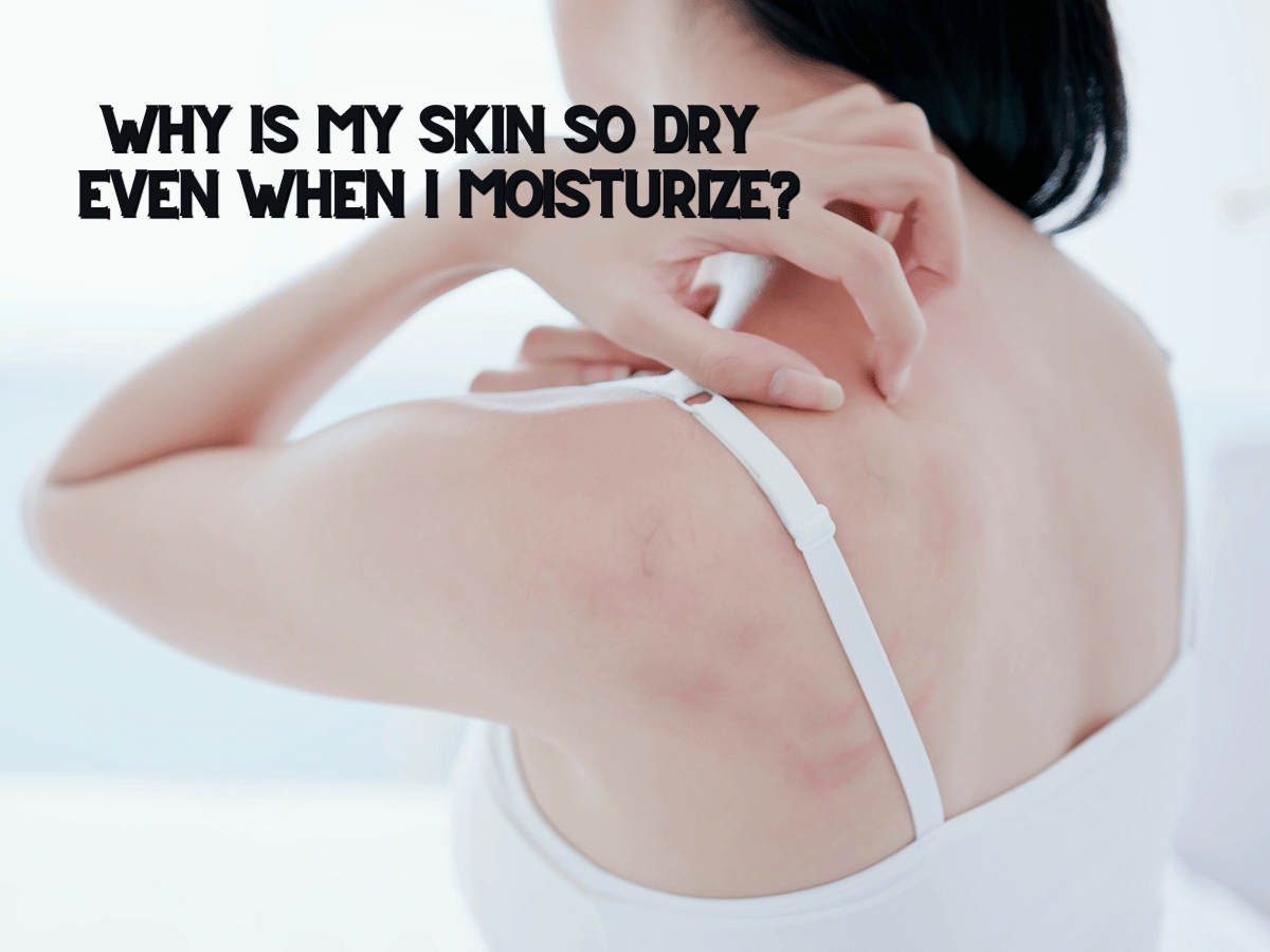 Why Is My Skin So Dry Even When I Moisturize?